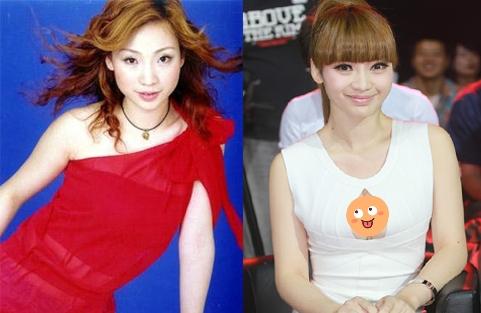 明星隆胸背后的審美趨勢與個(gè)人立場探討