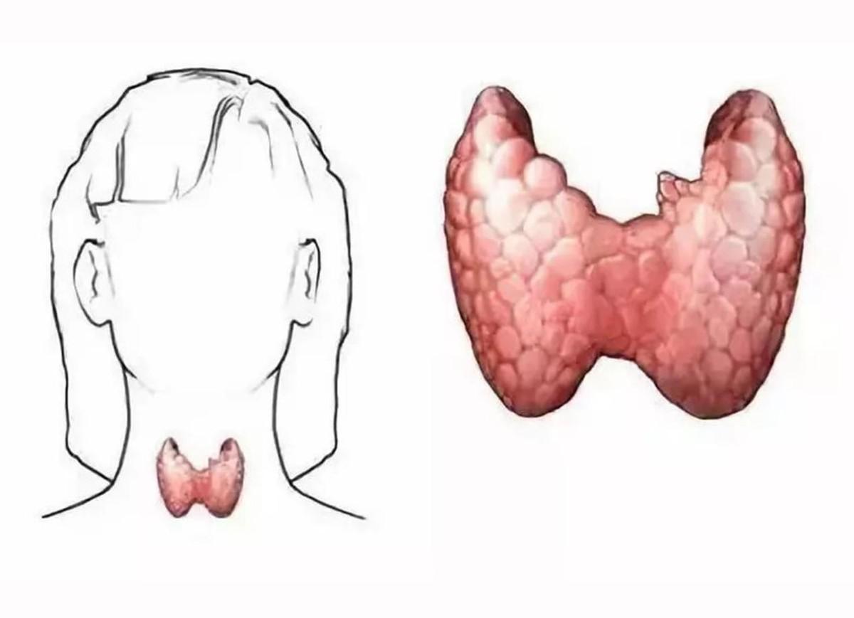 最新甲狀腺檢查步驟指南，詳細(xì)步驟解析
